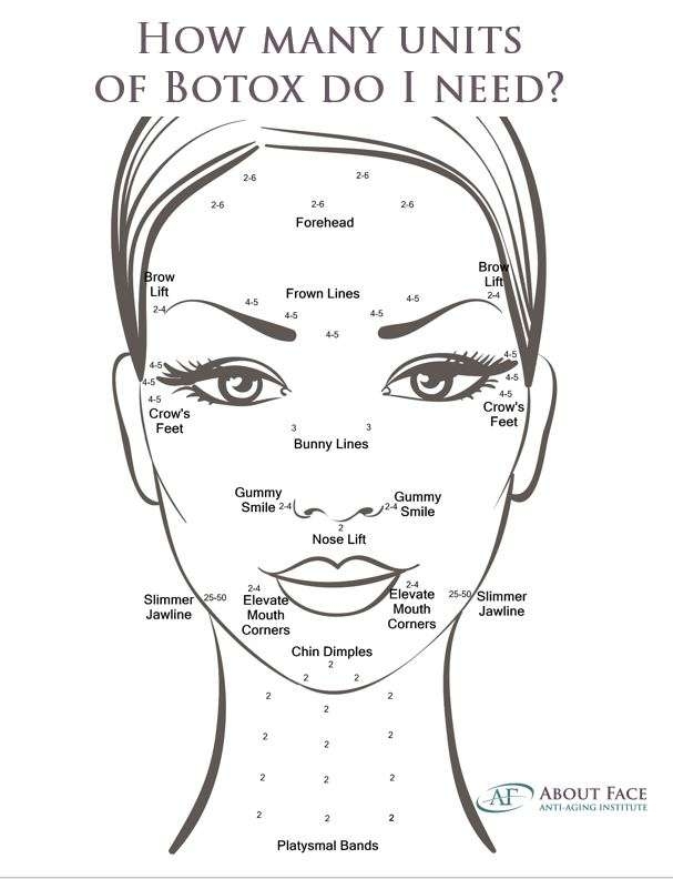 Free Printable Botox Face Chart