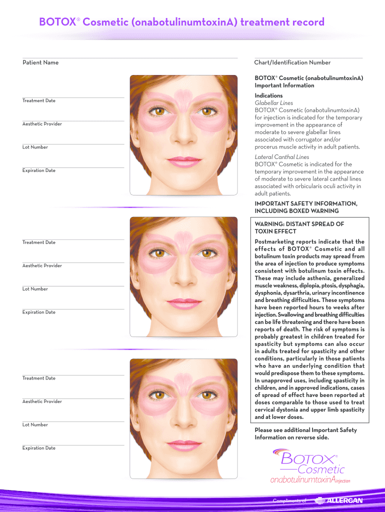 Printable Botox Face Chart Free Printable Templates