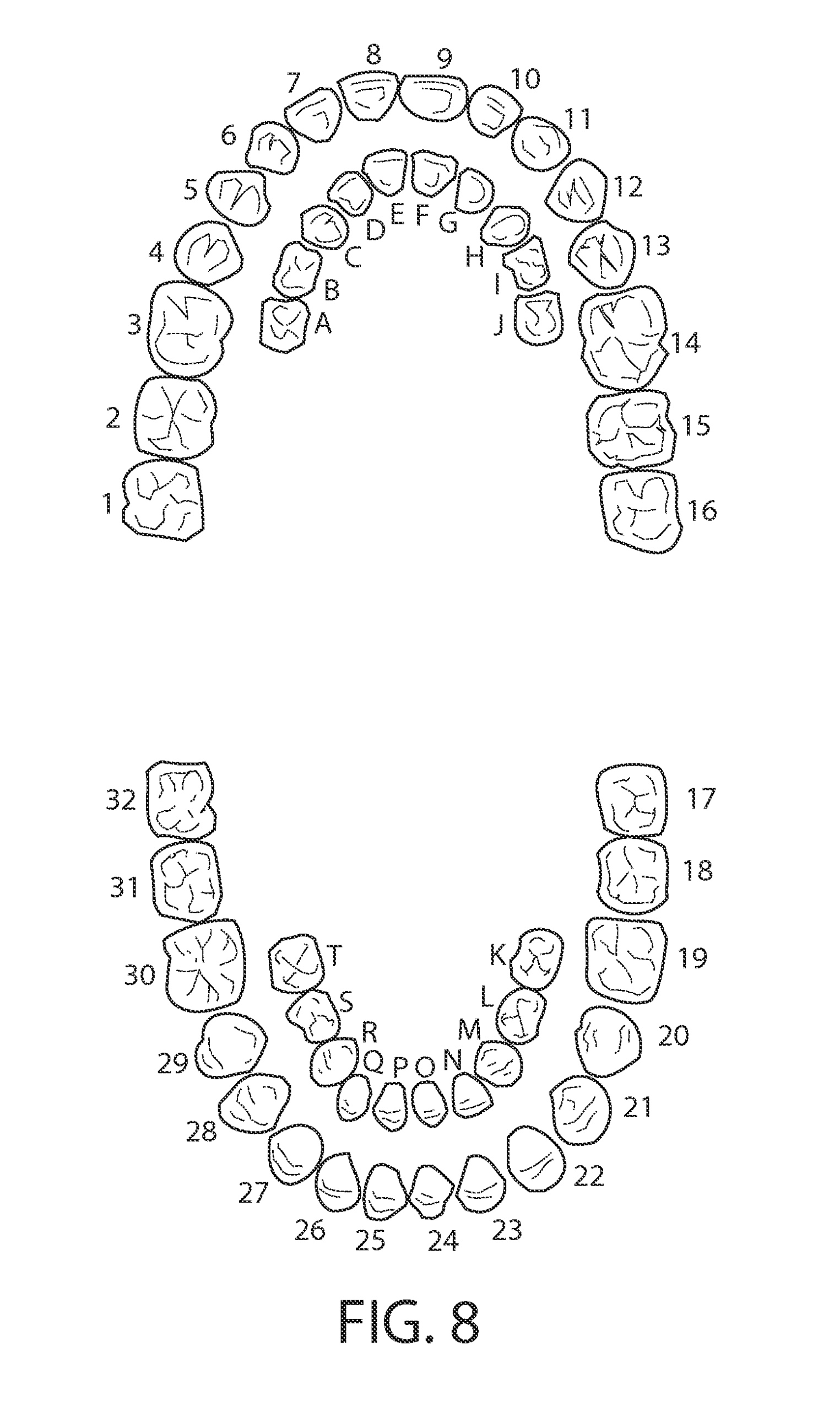 Printable Tooth Chart With Numbers And Letters
